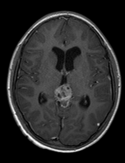 pinealomai7430.jpg